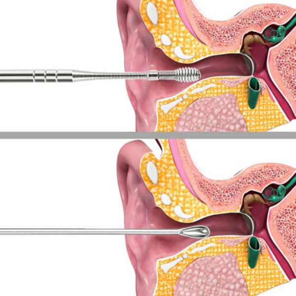 6 Pieces Stainless Steel Ear Cleaning Kit - Image 2